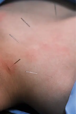 clear鍼灸院 清水【吉祥寺】のエステ・リラクイメージ