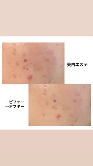 Coco Calin 𓇼山脇愛のエステ・リラクイメージ