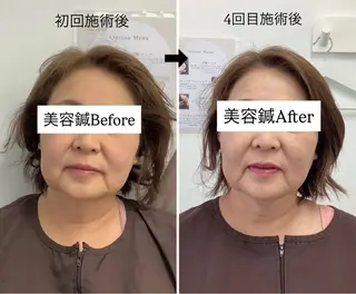 美容鍼灸×小顔整体♡ ハリサロンドオフ堺東のその他イメージ