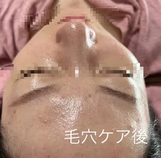 エステサロン 藍月レイクタウンのエステ・リラクイメージ