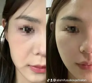 ネイル aliaハーブ水光店 エステティシャン募集のエステ・リラクイメージ