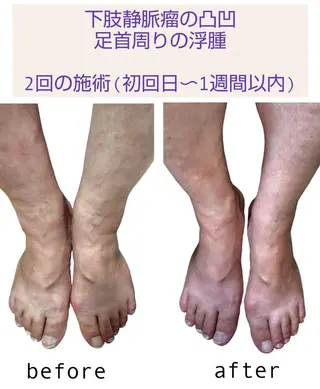 Ichi Fluo rite Bodyのエステ・リラクイメージ