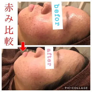 セミロング カラー パーマ ヘアアレンジ メンズ キッズ ネイル マツエク・マツパ 金の糸脱毛 産毛ケア専門のエステ・リラクイメージ