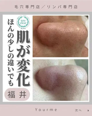 毛穴肌質ケアサロン Yourmeユアミーのエステ・リラクイメージ