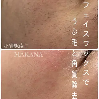 MAKANA 吉岡 小岩店のエステ・リラクイメージ