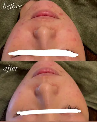 Ellebeauty relaxationのエステ・リラクイメージ