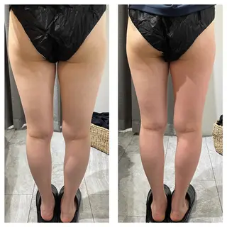 部分痩せ♥️小顔専門 MIKUのエステ・リラクイメージ