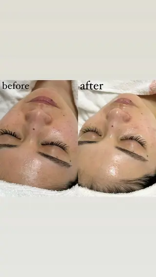 女性専門お顔剃り sunraineのエステ・リラクイメージ