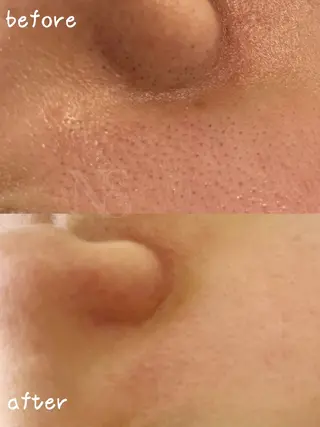 Nature Souce毛穴専門店のその他イメージ