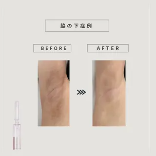 REBOND K モデル募集のマツエク・マツパデザイン