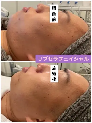 メンズ プライベートサロン プリュネルのエステ・リラクイメージ