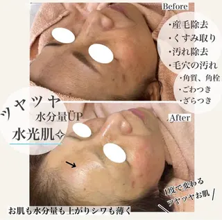 ネイル 肌管理&nail Salon  Duxのエステ・リラクイメージ