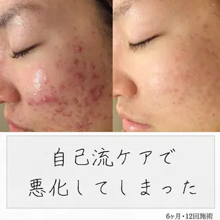 ニキビ経験者が施術 する専門サロン🌻のエステ・リラクイメージ