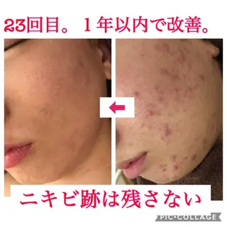 セミロング カラー パーマ ヘアアレンジ メンズ キッズ ネイル マツエク・マツパ 金の糸脱毛 産毛ケア専門のエステ・リラクイメージ