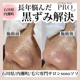 salon soso(ソソ)のエステ・リラクイメージ