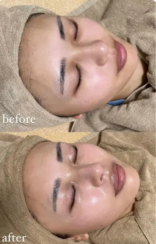 エステサロン Mi-mi.iのエステ・リラクイメージ