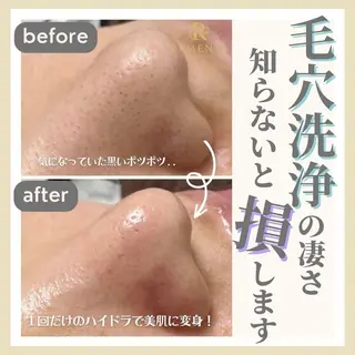 ISKAGO/ chisatoのエステ・リラクイメージ