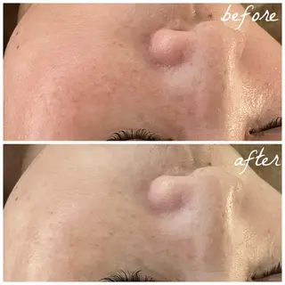 メンズ メナード岐阜市茜部 杉浦のエステ・リラクイメージ