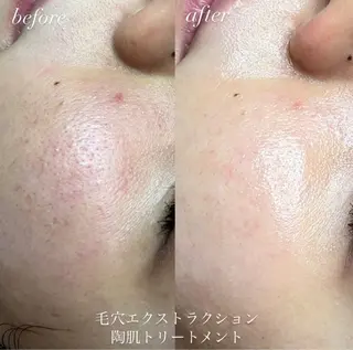 beautysalonW所属・beauty salonWのエステ・リラクイメージ