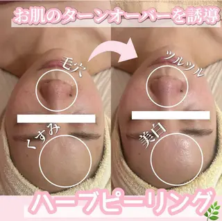 SALON韓国肌管理 東別院のエステ・リラクイメージ