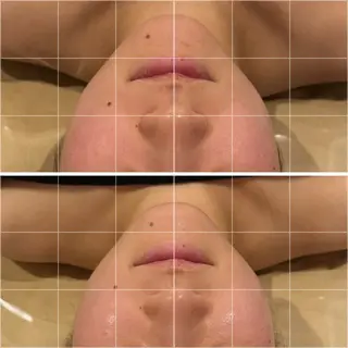 小顔EX心斎橋 REVIハーブのエステ・リラクイメージ