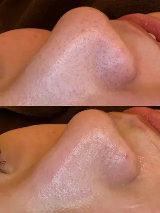 🤍アベシュリ /フェイシャル🤍のエステ・リラクイメージ