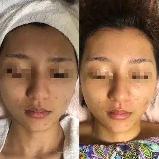 エスカル ボーテのエステ・リラクイメージ