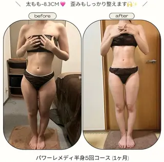 《本気痩せ×疲労改善 》  BILOOPのエステ・リラクイメージ