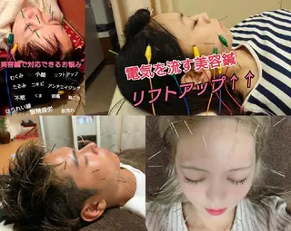 メンズ 美容鍼灸師 皆吉 秀樹のエステ・リラクイメージ
