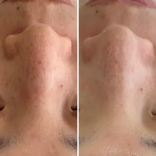 cut・the洒落夢　美肌フェイシャル所属・西本 裕子のエステ・リラクイメージ