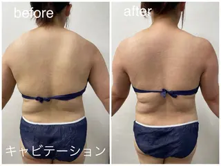 Reid-月詠-所属・Reid -月詠-のエステ・リラクイメージ