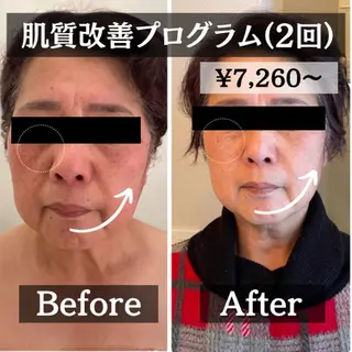 羽賀 茉衣子のエステ・リラクイメージ