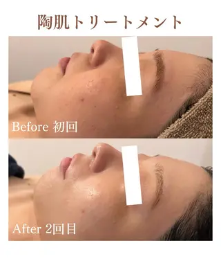 フェイシャルサロンLusis所属・肌質改善専門サロン Lusisのエステ・リラクイメージ