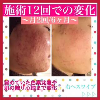 ミディアム カラー パーマ ヘアアレンジ メンズ キッズ ネイル マツエク・マツパ ニキビ・肌質改善専門 ♡人生が変わるサロンのエステ・リラクイメージ