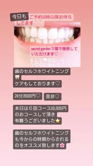 ☆SG☆ とも🌟のマツエク・マツパデザイン