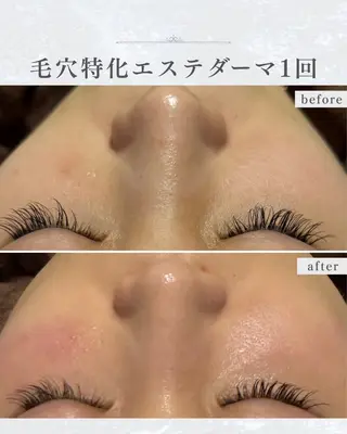 シミ取り×毛穴エステ YUKIのエステ・リラクイメージ