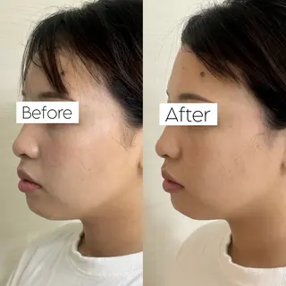 ロング salon  Stellum所属・Stellum 小顔矯正&ヘッドスパのエステ・リラクイメージ