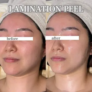 東大阪/韓国肌管理/ 痩身バスト専門店のエステ・リラクイメージ