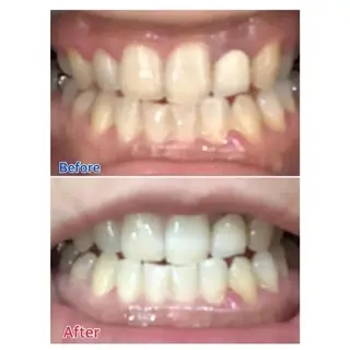 Ｍ渋谷 ホワイトニングのエステ・リラクイメージ