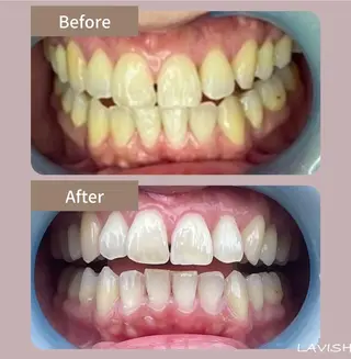 LAVISH nail salonのヘアスタイル