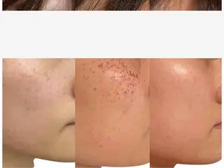 小顔専門看護師クリニカルサロンCOCO所属・小顔と美肌サロン クリニカルサロンココのエステ・リラクイメージ