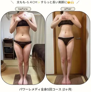 《本気痩せ×疲労改善 》  BILOOPのエステ・リラクイメージ