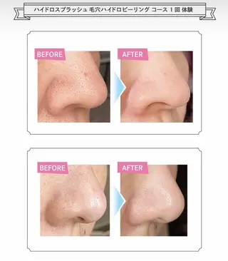 NICONUTS よもぎハーブ蒸しのエステ・リラクイメージ