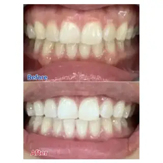 M渋谷 ホワイトニングのエステ・リラクイメージ