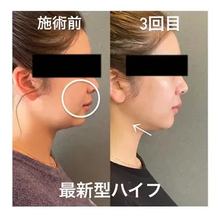 beauty salon epのエステ・リラクイメージ