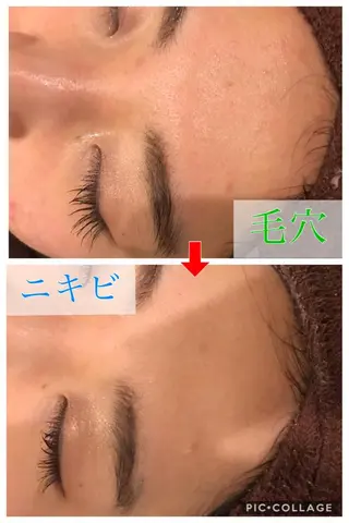 ミディアム カラー パーマ ヘアアレンジ メンズ キッズ ネイル マツエク・マツパ 金の糸脱毛 産毛ケア専門のエステ・リラクイメージ