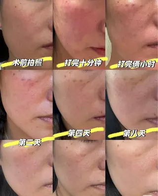 マツエク・マツパ 愛維美水光美肌専門店 メンズレディースokのエステ・リラクイメージ
