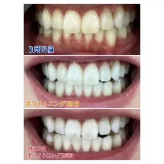 M渋谷 ホワイトニングのエステ・リラクイメージ