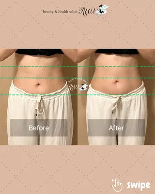 【頭痛、睡眠改善】 salon RUUのエステ・リラクイメージ