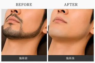 眉毛ぐせ改善サロン airy junの眉毛・アイブロウイメージ